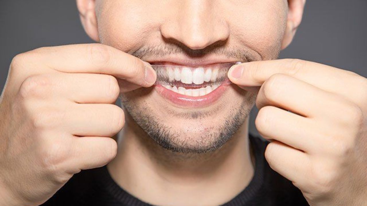 Advantages of Getting Free Teeth Whitening Strip Samples